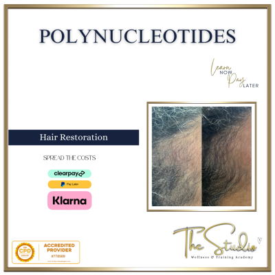 Polynucleotides for Hair Restoration